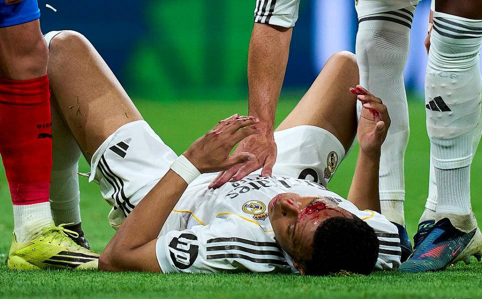 争议再起！姆巴佩受伤流血，主裁拒判点球，皇马官方强烈指责西甲暗箱操作